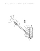 Percutaneous Puncture Sealing System diagram and image