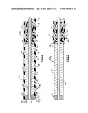 Percutaneous Puncture Sealing System diagram and image