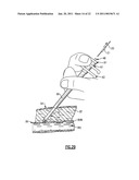 Percutaneous Puncture Sealing System diagram and image