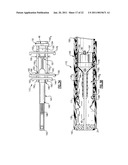 Percutaneous Puncture Sealing System diagram and image