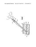 Percutaneous Puncture Sealing System diagram and image