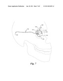 Fitting of Brightness in a Visual Prosthesis diagram and image