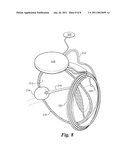 Fitting of Brightness in a Visual Prosthesis diagram and image