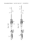 TRANSAPICAL DELIVERY SYSTEM FOR HEART VALVES diagram and image