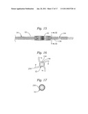 TRANSAPICAL DELIVERY SYSTEM FOR HEART VALVES diagram and image