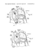 Devices, systems, and methods for reshaping a heart valve annulus, including the use of magnetic tools diagram and image