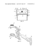 SPINAL IMPLANT CONFIGURED TO APPLY RADIATION TREATMENT AND METHOD diagram and image