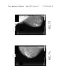 SYSTEMS AND METHODS FOR INTERLEAVING SERIES OF MEDICAL IMAGES diagram and image