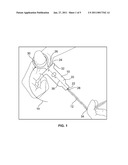 WIRE UNTWISTING TOOL diagram and image