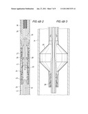 Nitinol Spring Through Tubing Bridge Plug diagram and image