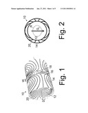 ISO-PLANE BACKBONE FOR RADIATION DETECTORS diagram and image