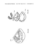 APPARATUS FOR SANITIZING ORAL APPLIANCES diagram and image