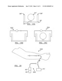 Microfluidic method and system for isolating particles from biological fluid diagram and image