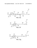 Demolding device for injection molding part with undercut diagram and image