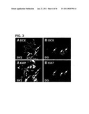 USE OF REGULATORY SEQUENCES FOR SPECIFIC, TRANSIENT EXPRESSION IN NEURONAL DETERMINED CELLS diagram and image