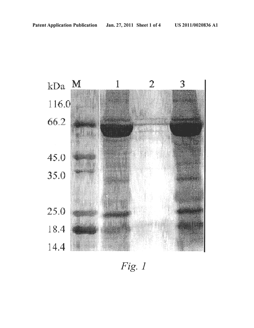 PROCESS FOR DIFFERENTIAL POLYPEPTIDES DETECTION AND USES THEREOF - diagram, schematic, and image 02