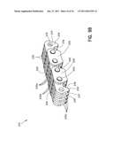 Inverted Tooth Chain and Sprocket Drive System with Reduced Meshing Impact diagram and image