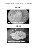 DITHIOCARBAMATES AND PHOSPHITE FORMULATIONS diagram and image