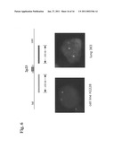 Gene Defects And Mutant ALK Kinase In Human Solid Tumors diagram and image