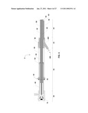 ENDOVENTRICULAR INJECTION CATHETER SYSTEM WITH INTEGRATED ECHOCARDIOGRAPHIC CAPABILITIES diagram and image