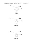 ENDOVENTRICULAR INJECTION CATHETER SYSTEM WITH INTEGRATED ECHOCARDIOGRAPHIC CAPABILITIES diagram and image