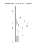 ENDOVENTRICULAR INJECTION CATHETER SYSTEM WITH INTEGRATED ECHOCARDIOGRAPHIC CAPABILITIES diagram and image