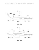 ENDOVENTRICULAR INJECTION CATHETER SYSTEM WITH INTEGRATED ECHOCARDIOGRAPHIC CAPABILITIES diagram and image