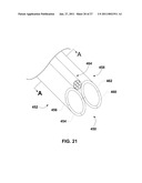 ENDOVENTRICULAR INJECTION CATHETER SYSTEM WITH INTEGRATED ECHOCARDIOGRAPHIC CAPABILITIES diagram and image