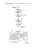 USE OF FOCUSED ULTRASOUND FOR VASCULAR SEALING diagram and image