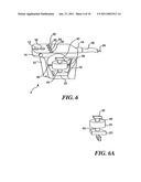 USE OF FOCUSED ULTRASOUND FOR VASCULAR SEALING diagram and image