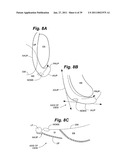 Devices and methods for minimally invasive access to sinuses and treatment of sinusitis diagram and image