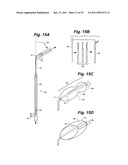 Devices and methods for minimally invasive access to sinuses and treatment of sinusitis diagram and image