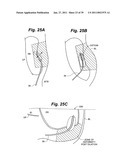 Devices and methods for minimally invasive access to sinuses and treatment of sinusitis diagram and image