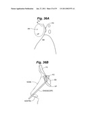 Devices and methods for minimally invasive access to sinuses and treatment of sinusitis diagram and image