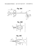 Devices and methods for minimally invasive access to sinuses and treatment of sinusitis diagram and image