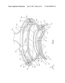 LIQUID HOLDING INTERFACE DEVICE FOR OPHTHALMIC LASER PROCEDURES diagram and image