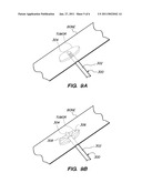 TISSUE ABLATION PROBES AND METHODS FOR TREATING OSTEOID OSTEOMAS diagram and image