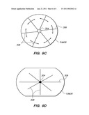 TISSUE ABLATION PROBES AND METHODS FOR TREATING OSTEOID OSTEOMAS diagram and image