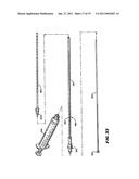 SYSTEMS AND METHODS FOR PLACING MATERIALS INTO BONE diagram and image