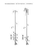 SYSTEMS AND METHODS FOR PLACING MATERIALS INTO BONE diagram and image