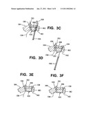 APPARATUS AND METHOD FOR REPAIRING TISSUE diagram and image