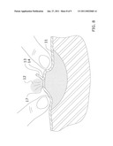 Surgical Skin Punch Apparatus diagram and image