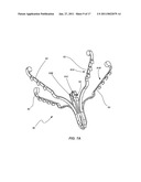 MEDICAL DEVICE FOR MODIFICATION OF LEFT ATRIAL APPENDAGE AND RELATED SYSTEMS AND METHODS diagram and image