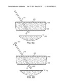 HEMOSTASIS-ENHANCING DEVICE AND METHOD FOR ITS USE diagram and image