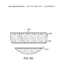 HEMOSTASIS-ENHANCING DEVICE AND METHOD FOR ITS USE diagram and image