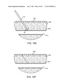 HEMOSTASIS-ENHANCING DEVICE AND METHOD FOR ITS USE diagram and image