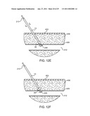 HEMOSTASIS-ENHANCING DEVICE AND METHOD FOR ITS USE diagram and image