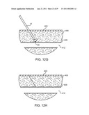 HEMOSTASIS-ENHANCING DEVICE AND METHOD FOR ITS USE diagram and image