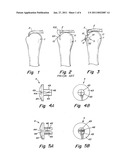 SUTURE FIXATION DEVICE AND METHOD FOR SURGICAL REPAIR diagram and image