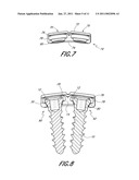 BONE PLATE SYSTEM AND METHODS OF USING THE SAME diagram and image